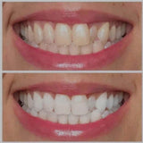 Ultra Violet Teeth Brightening Gel